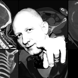 Аватар канала «Русская радиология - Цориев Андрей Эльдарович»